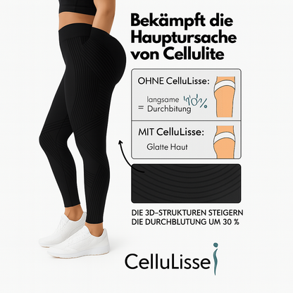 3D Anti-Cellulite Leggings