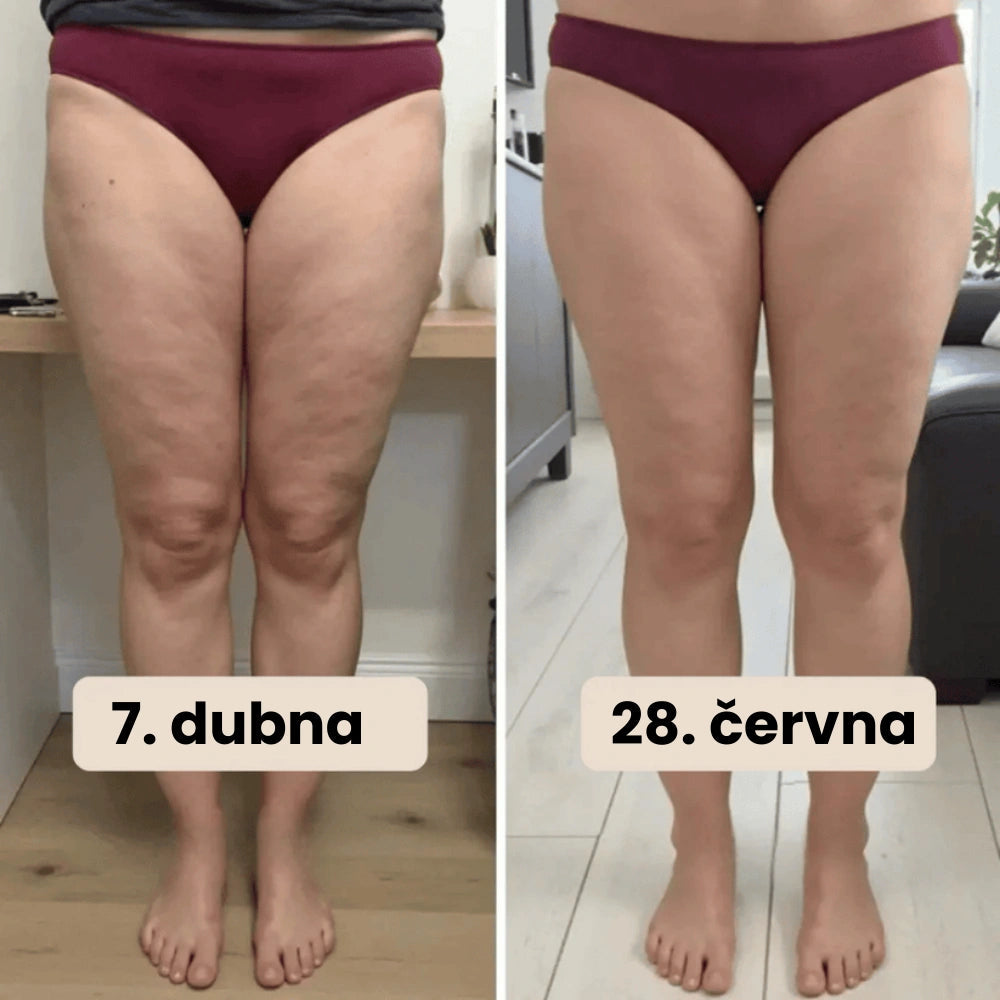 SlimCore® 3D legíny