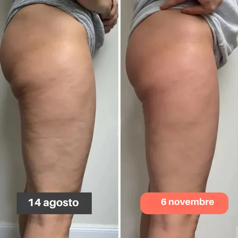 Leggings 3D Slimcore– Ridefinisci la tua silhouette senza sforzo