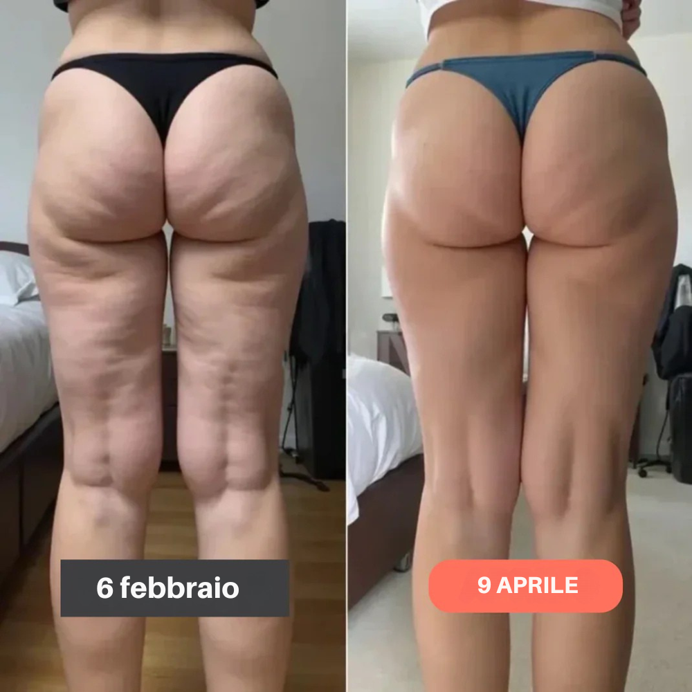 Leggings 3D Slimcore– Ridefinisci la tua silhouette senza sforzo