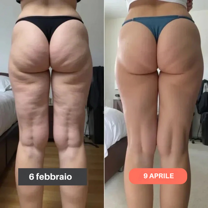 Leggings 3D Slimcore– Ridefinisci la tua silhouette senza sforzo