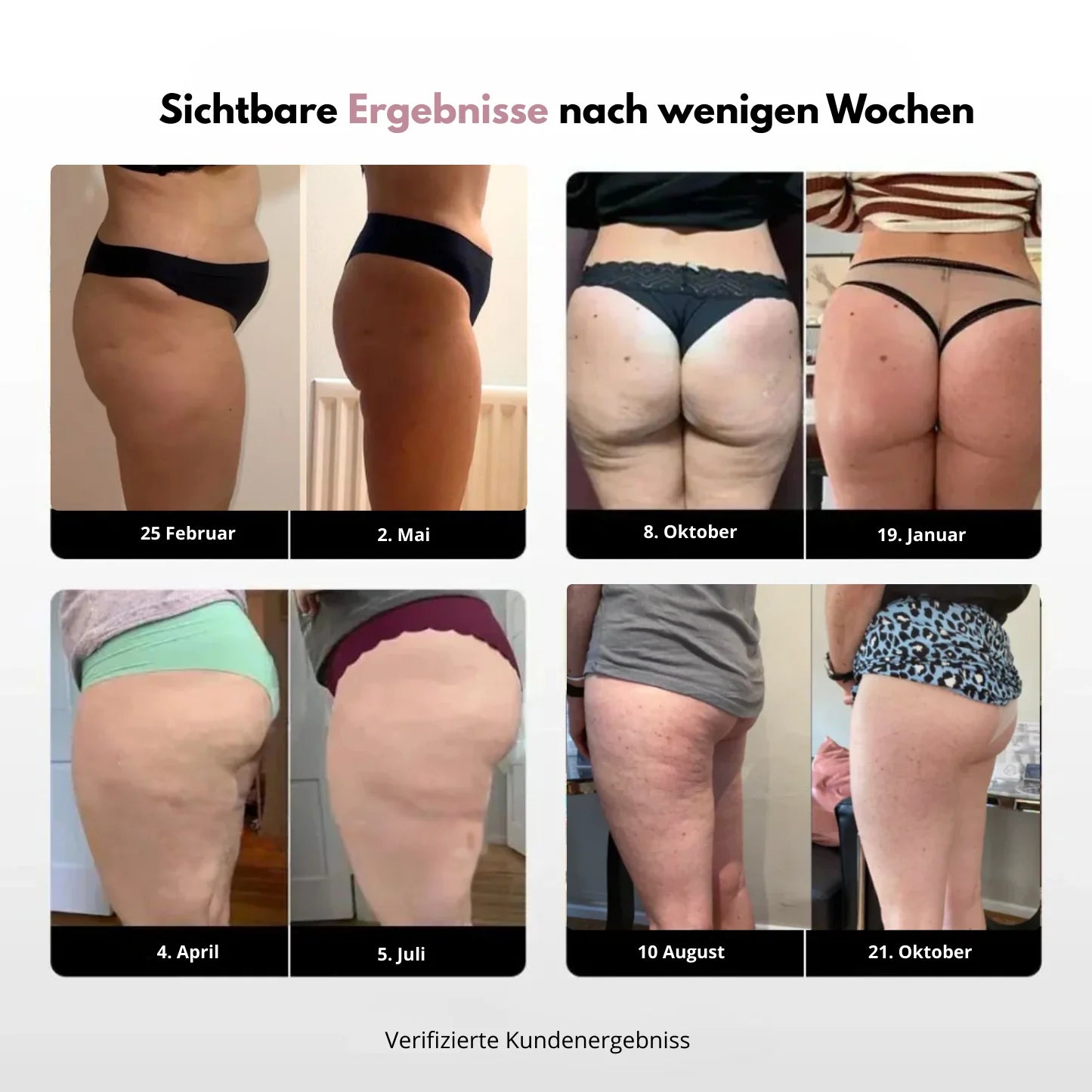 3D Anti-Cellulite Leggings