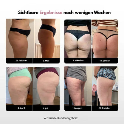 3D Anti-Cellulite Leggings